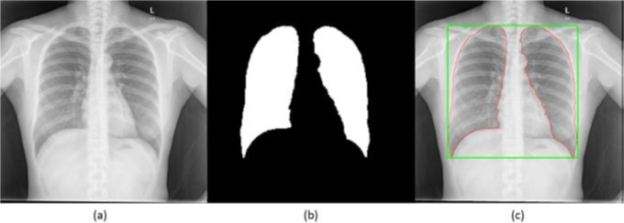 PA CXR lung ROI segmentation process: (a) original image, (b) computed lung mask, (c) segmented lung ROI with the bounding box.