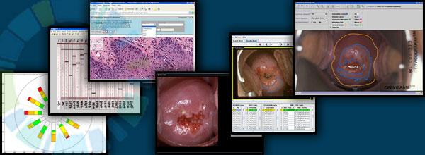 Image representing imaging tools for cancer research project